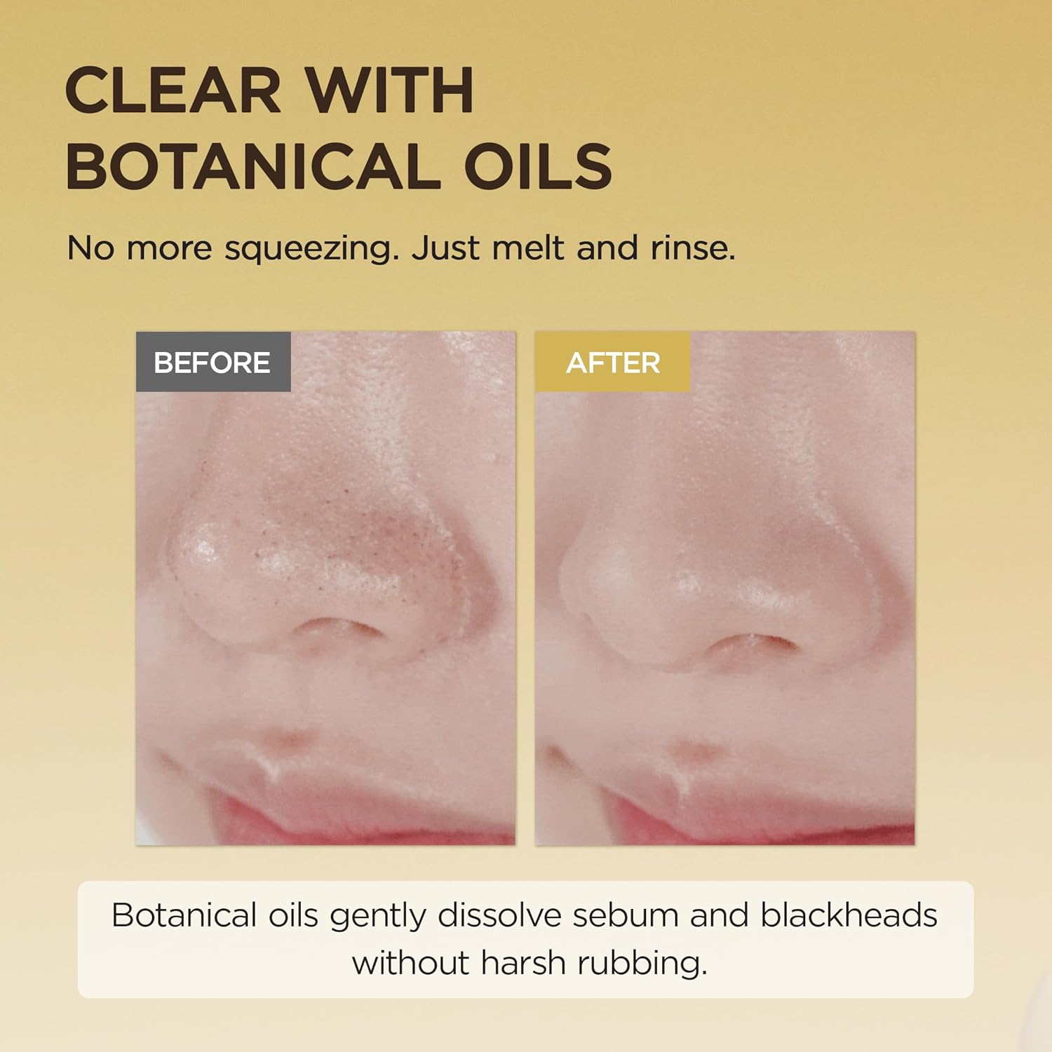 SKIN1004 - MADAGASCAR CENTELLA LIGHT CLEANSING OIL