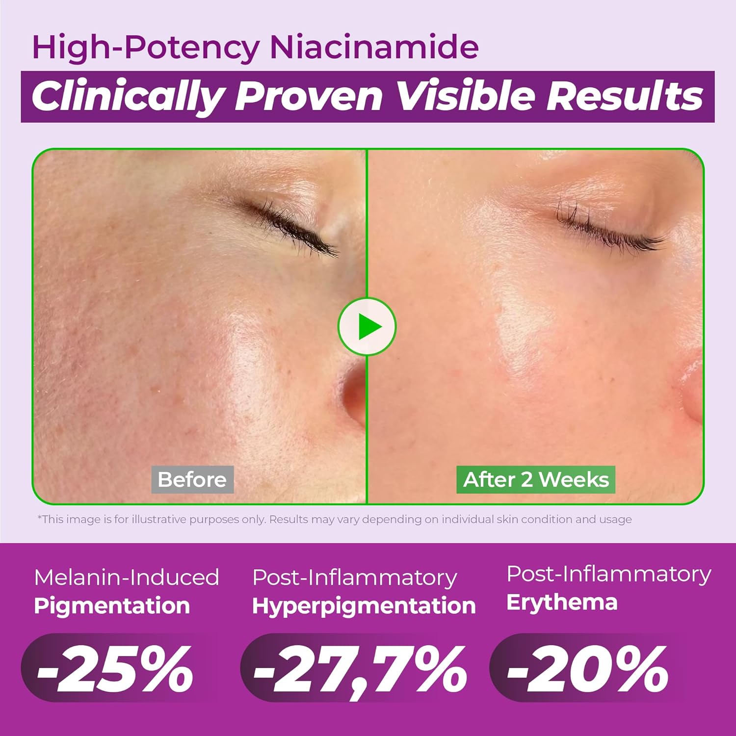 JUMISO - NIACINAMIDE 20% SERUM