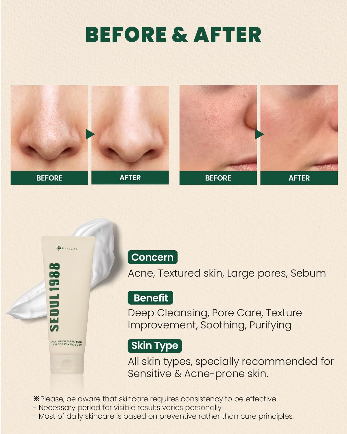 KSECRET -  SEOUL 1988 CLEANSING FOAM: PINE CICA 1 % + PROBIOTICS 150 ml