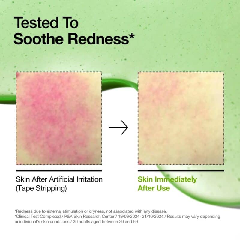 ANUA - AZELAIC ACID 10 HYALURON REDNESS SOOTHING SERUM 30ML - Image 3