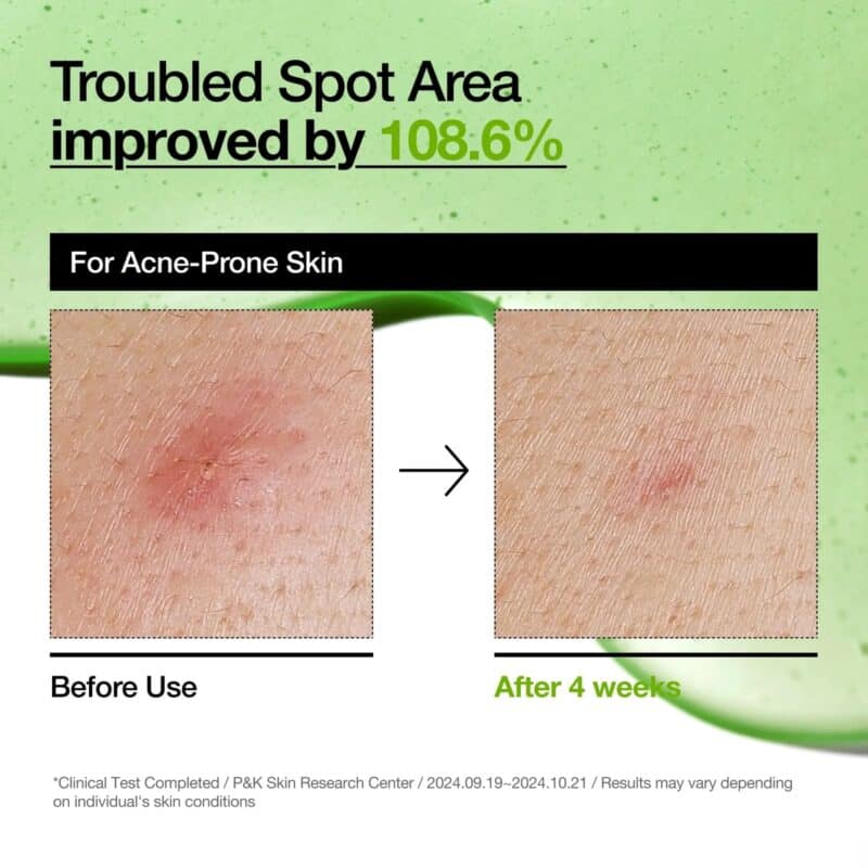 ANUA - AZELAIC ACID 10 HYALURON REDNESS SOOTHING SERUM 30ML - Image 4